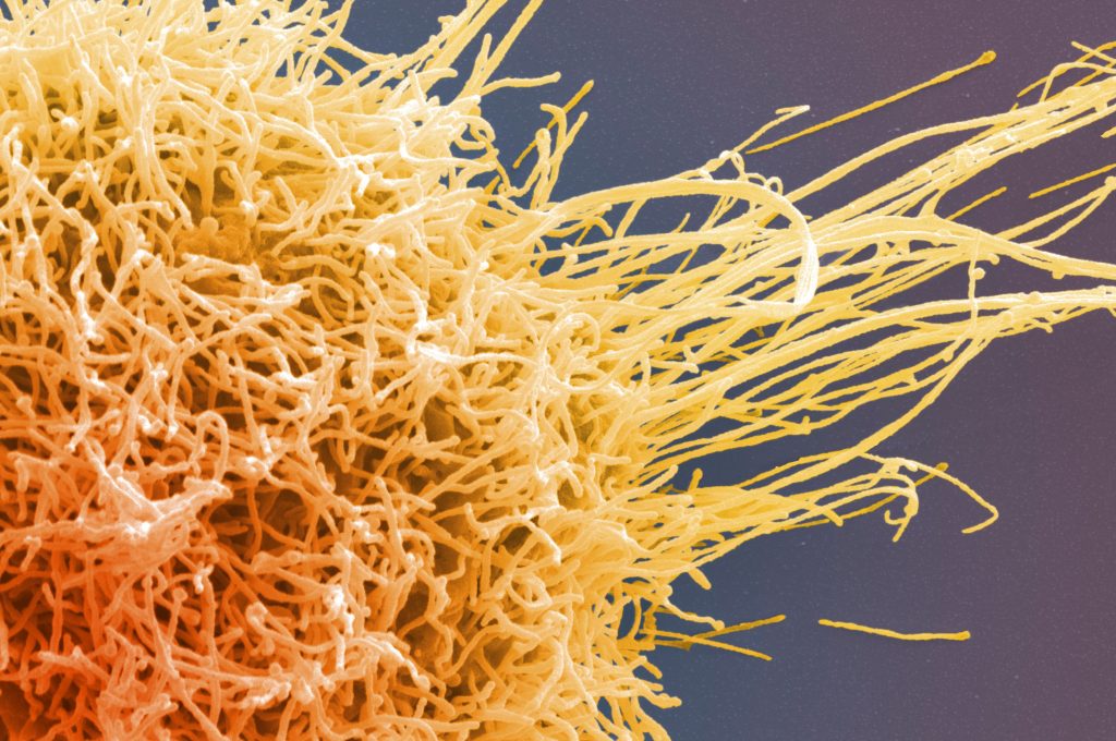 HeLa cell, immortal human epithelial cancer cell line, SEM Anne Weston, Francis Crick Institute