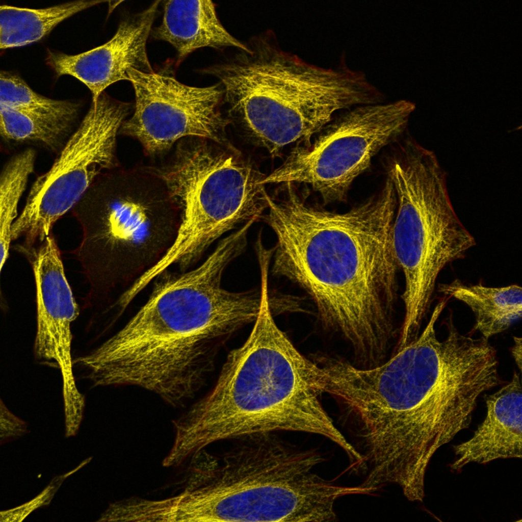 HeLa cells, LM Kevin Mackenzie, University of Aberdeen